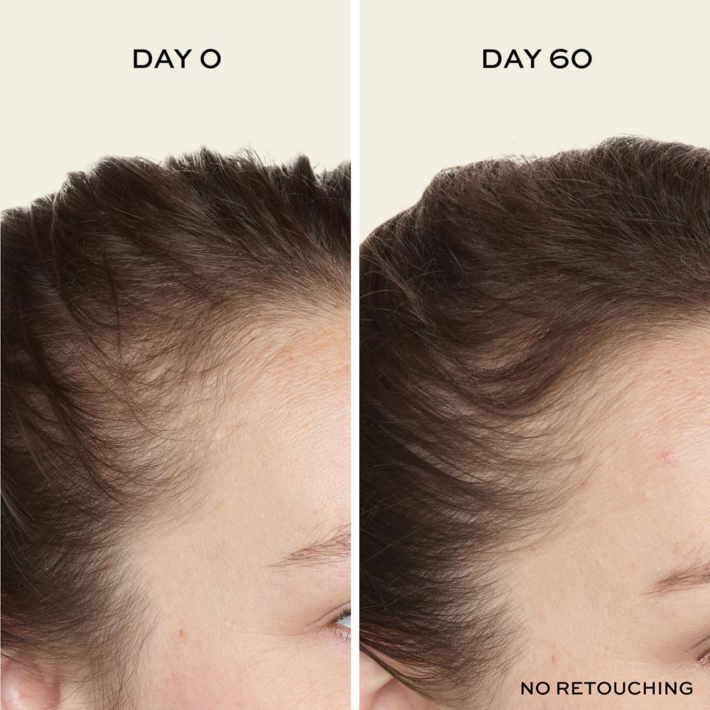 Before/After 60 Days with the John Frieda ULTRAfiller+ Hair Density Scalp Serum